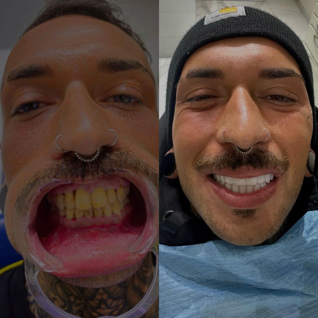 Caso prima e dopo 5